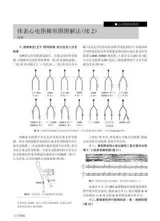 体表心电图梯形图图解法(续2)
