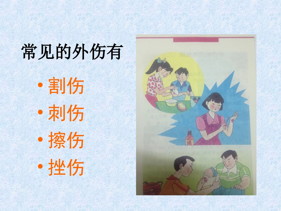 外伤的简单处理（一）_第2页
