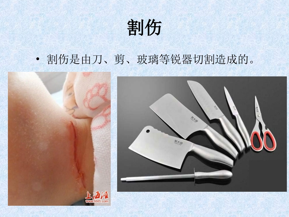 外伤的简单处理（一）_第3页