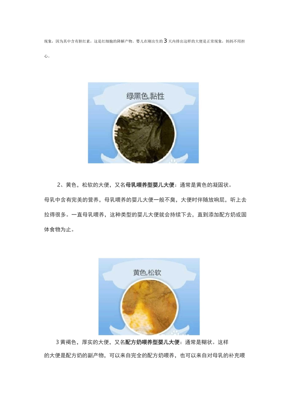 婴儿大便典型颜色性状图解_第2页