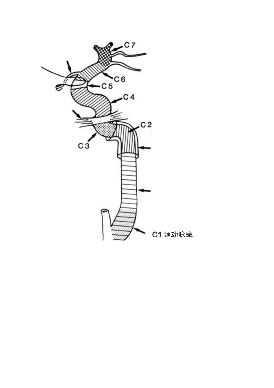 颈内动脉分段解剖_第2页