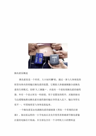 胰岛素泵使用及注意事项