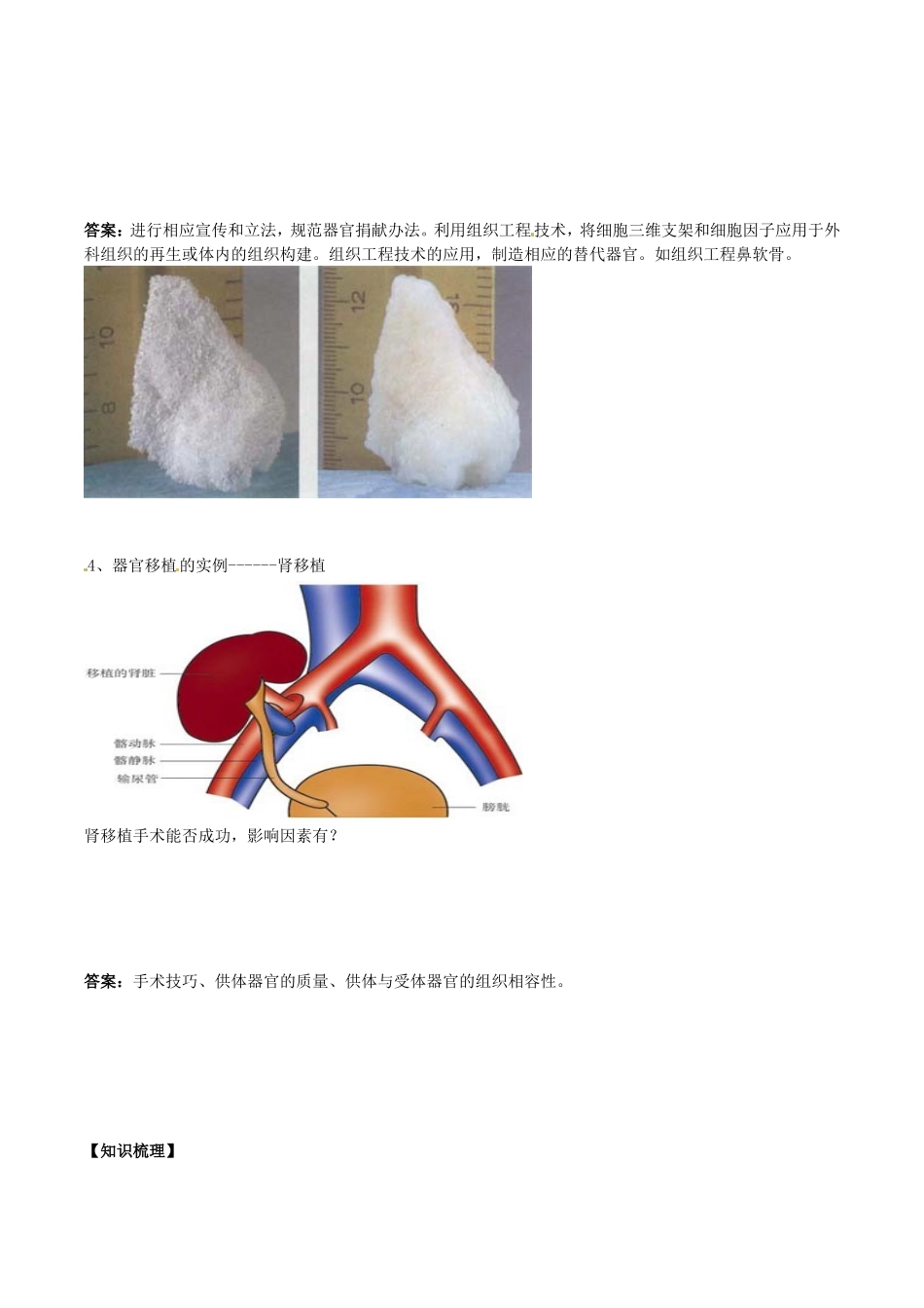 高中生物：1.3《人体的器官移植》学案新人教版选修2_第2页