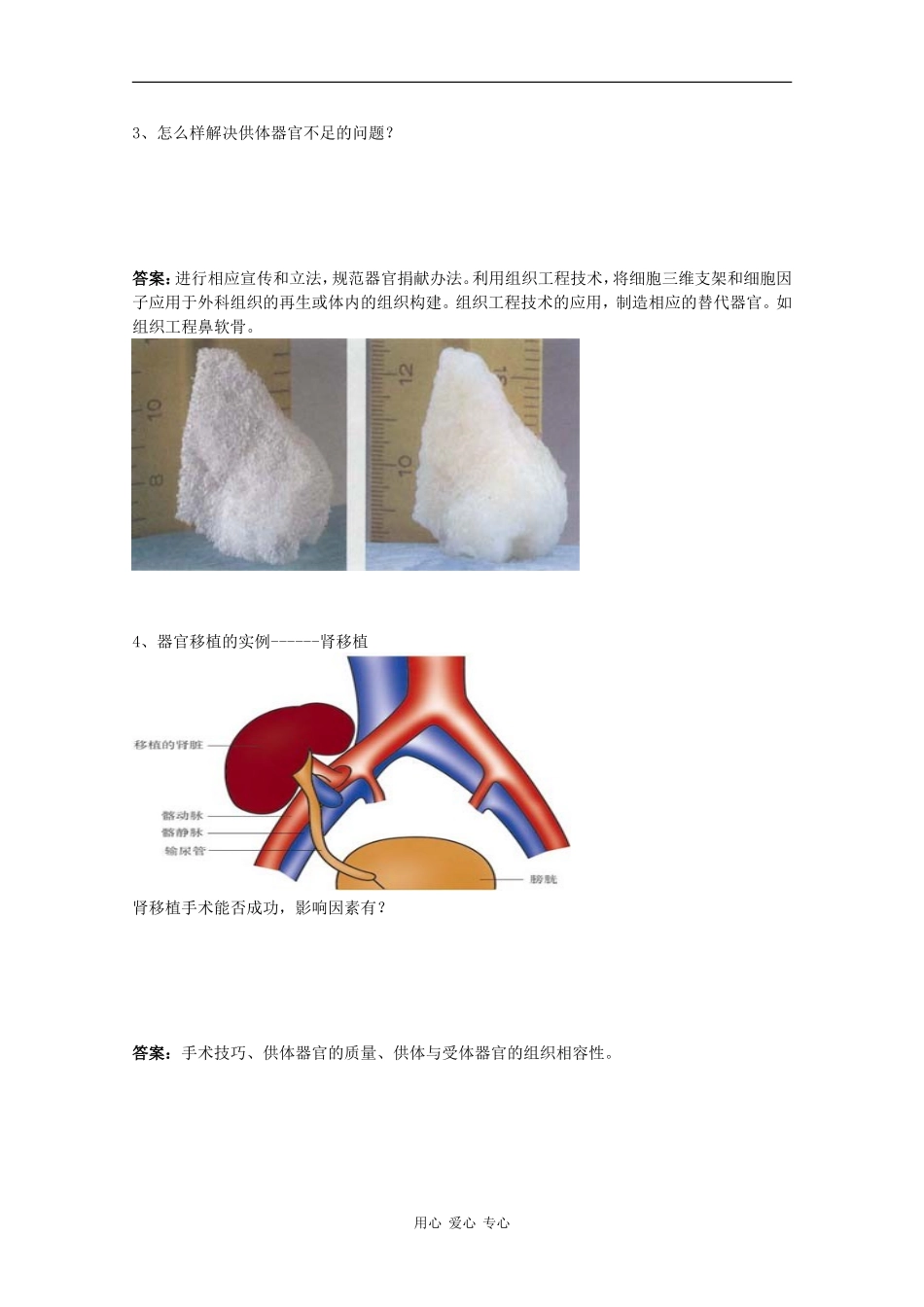 高中生物：3.1.2《器官移植》学案（1）中图版选修2_第2页