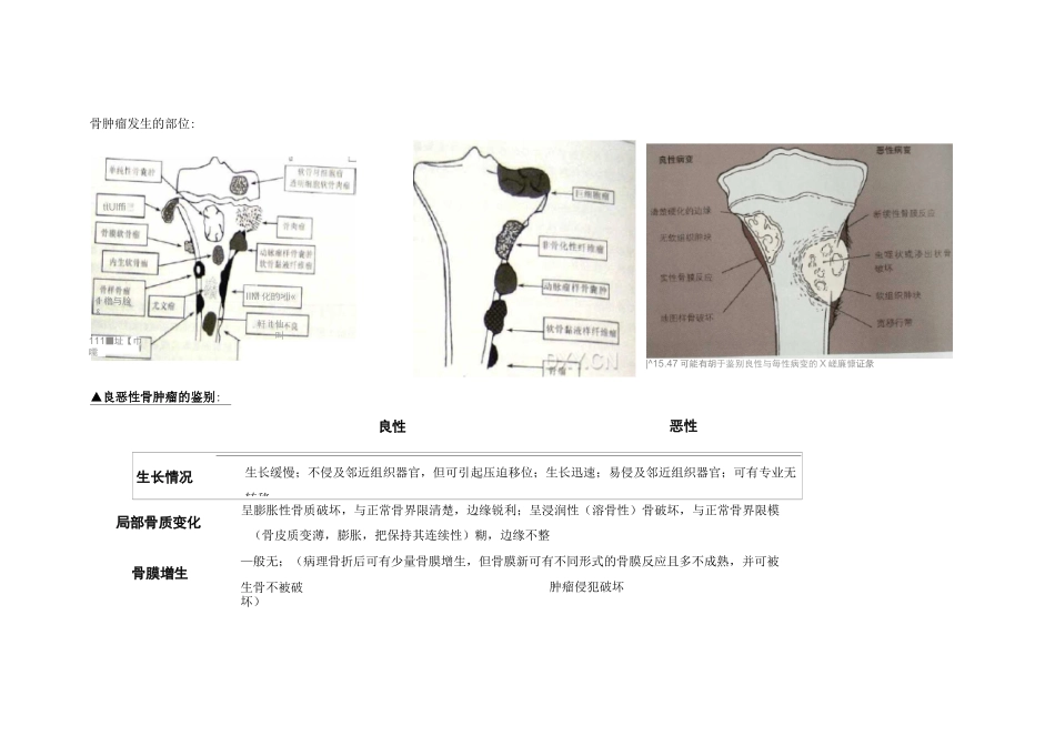 骨肿瘤鉴别诊断_第1页