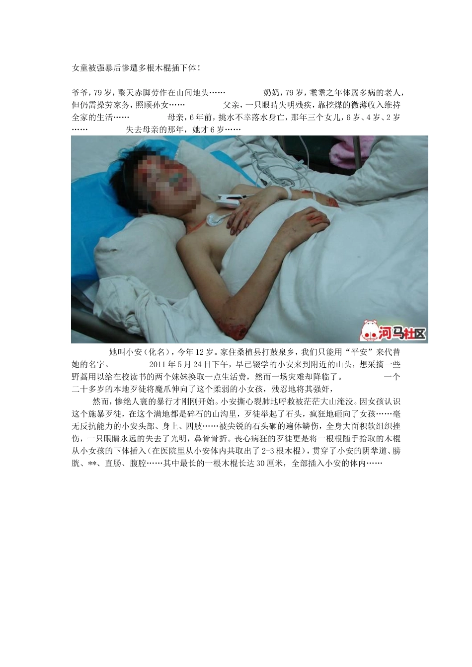 女童被强暴后惨遭多根木棍插下体_第1页