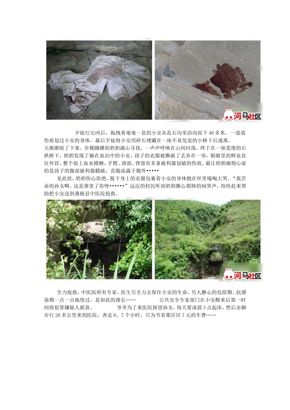女童被强暴后惨遭多根木棍插下体_第2页