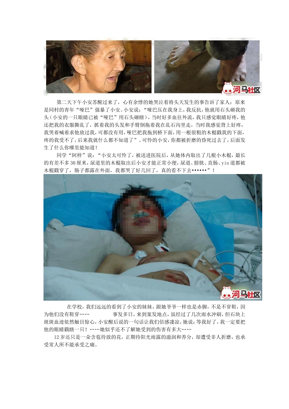 女童被强暴后惨遭多根木棍插下体_第3页