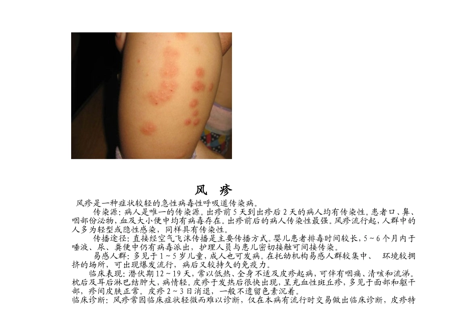 幼儿园常见传染病_第2页