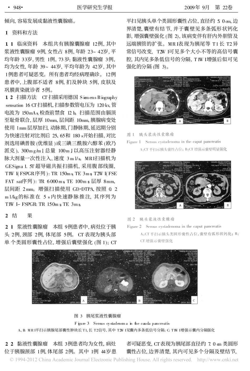 胰腺囊腺瘤的影像学诊断_第2页