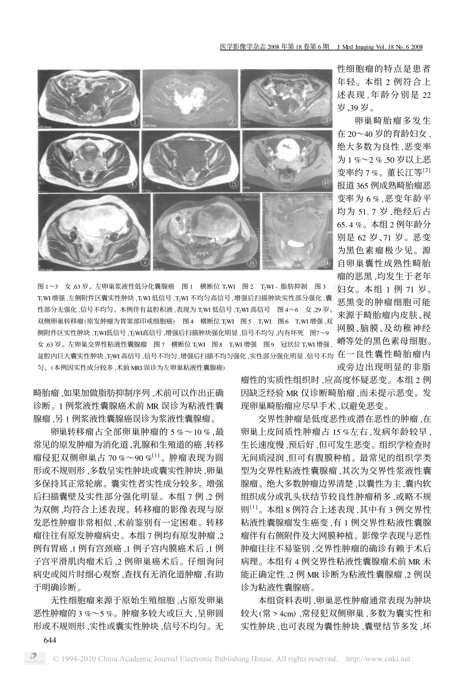 卵巢恶性肿瘤的MRI诊断_第3页