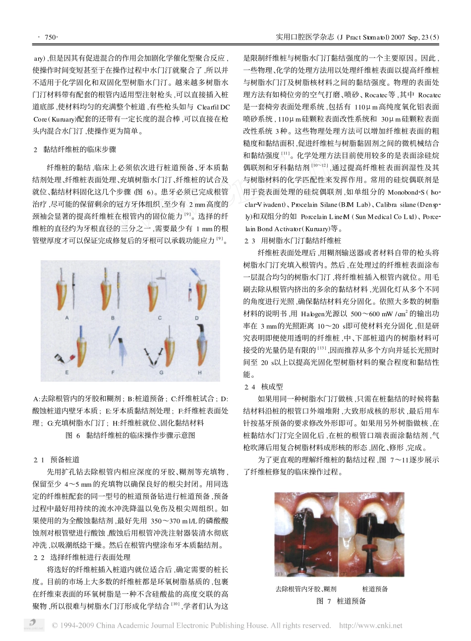 纤维桩修复技术的临床应用_第3页