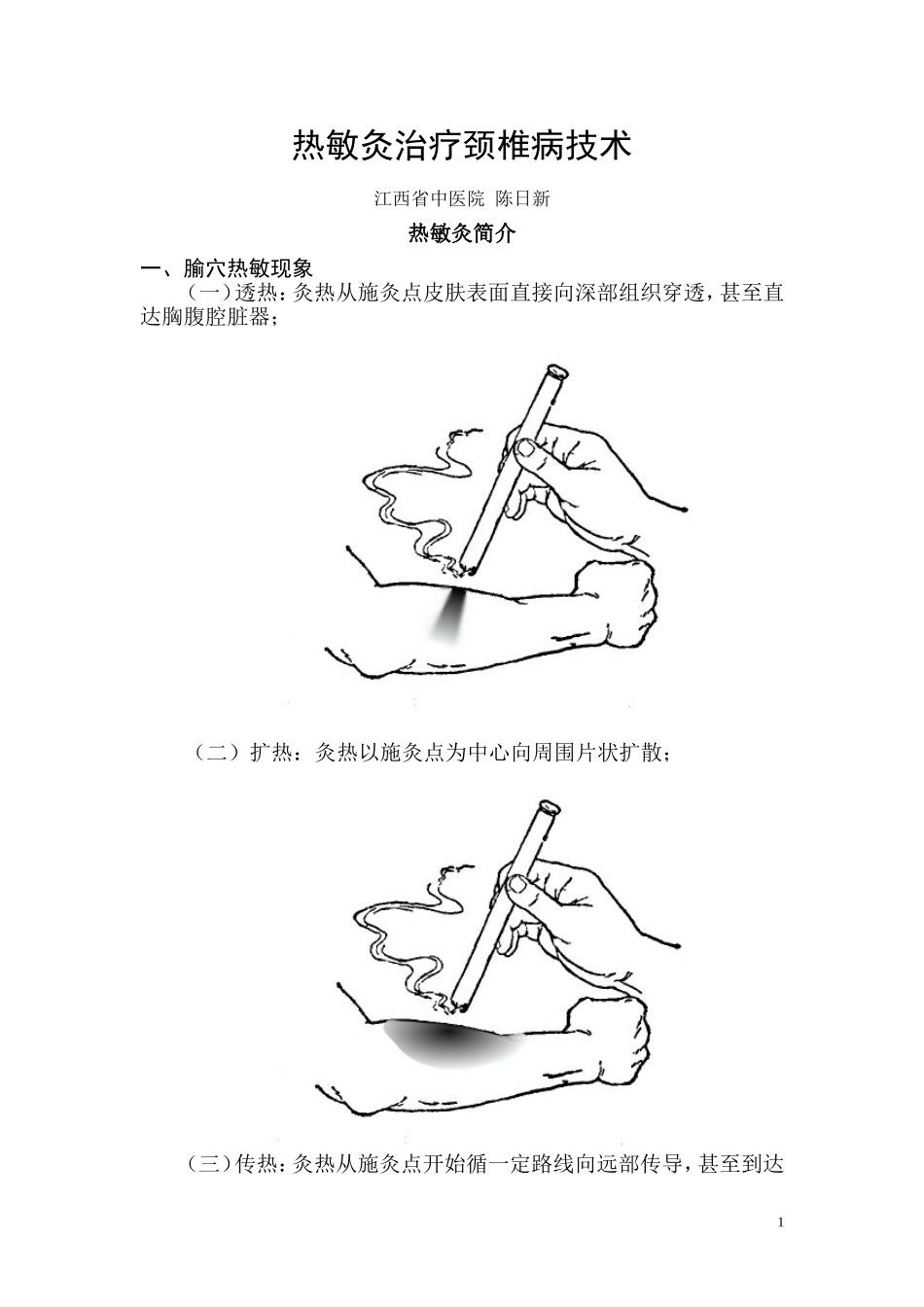 热敏灸治疗颈椎病技术===陈日新_第1页