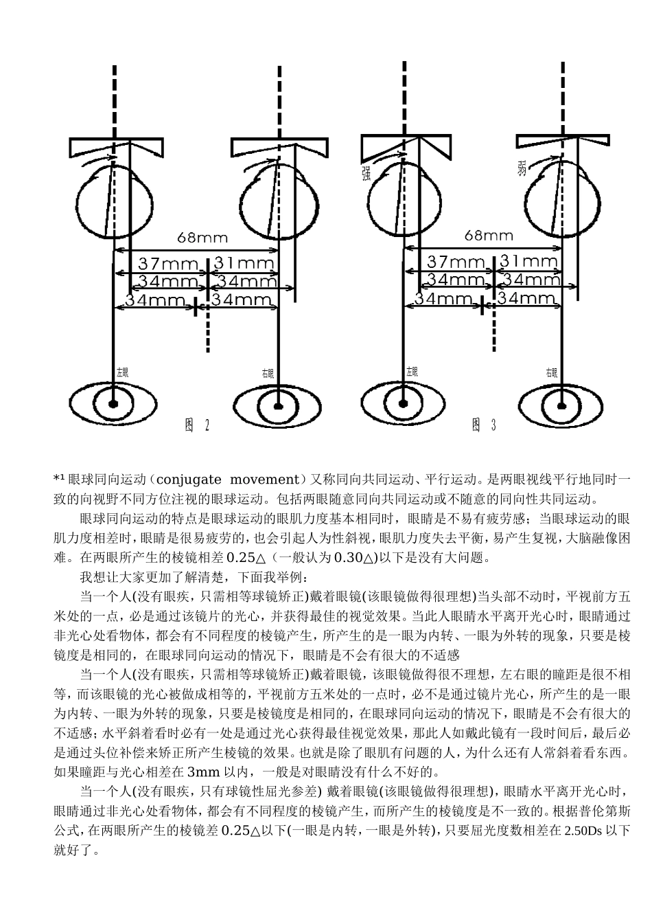 如何正确测量瞳孔距离---屈光参差_第3页
