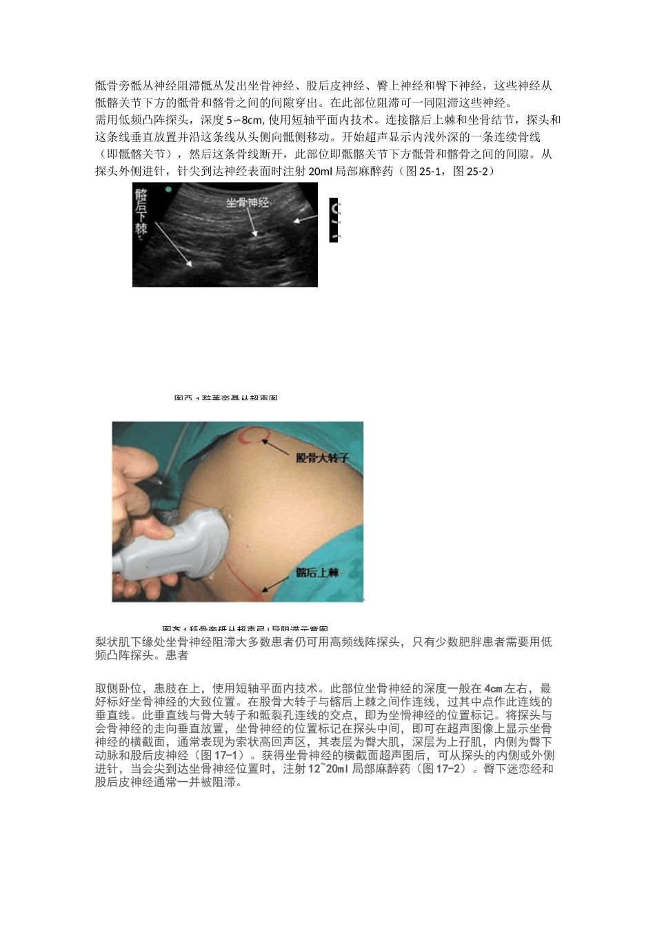 骶丛神经阻滞_第1页
