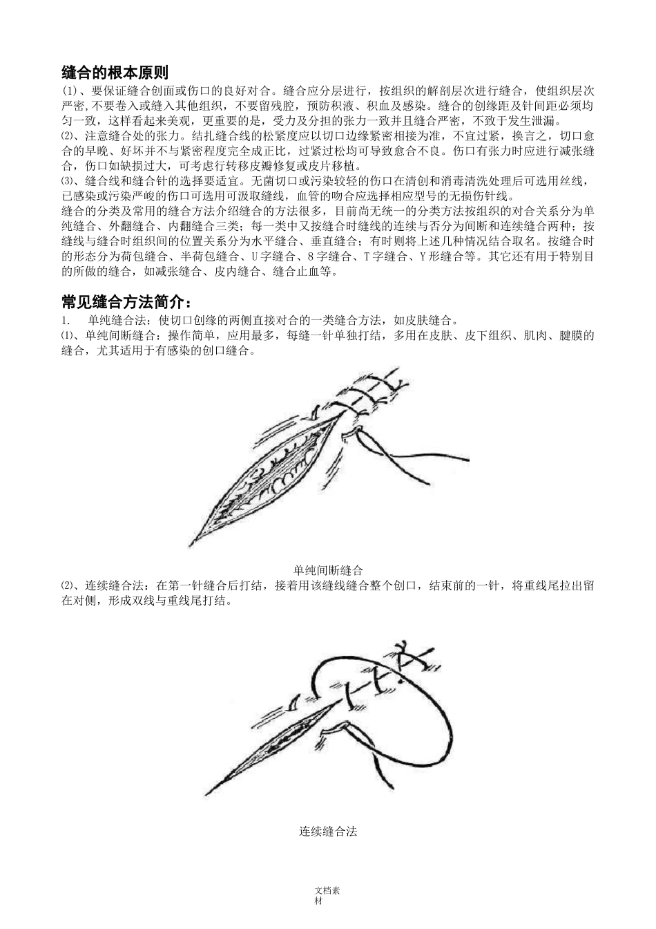 《外科手术缝合方法图解》_第2页