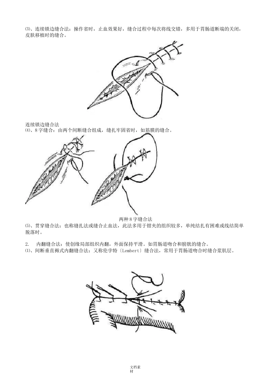 《外科手术缝合方法图解》_第3页