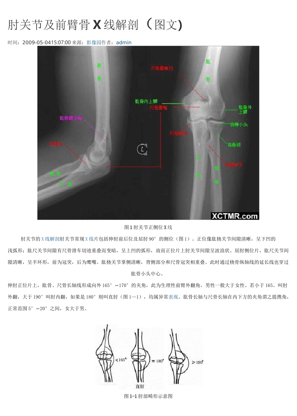 骨科X线解剖(四肢、关节)讲解_第1页