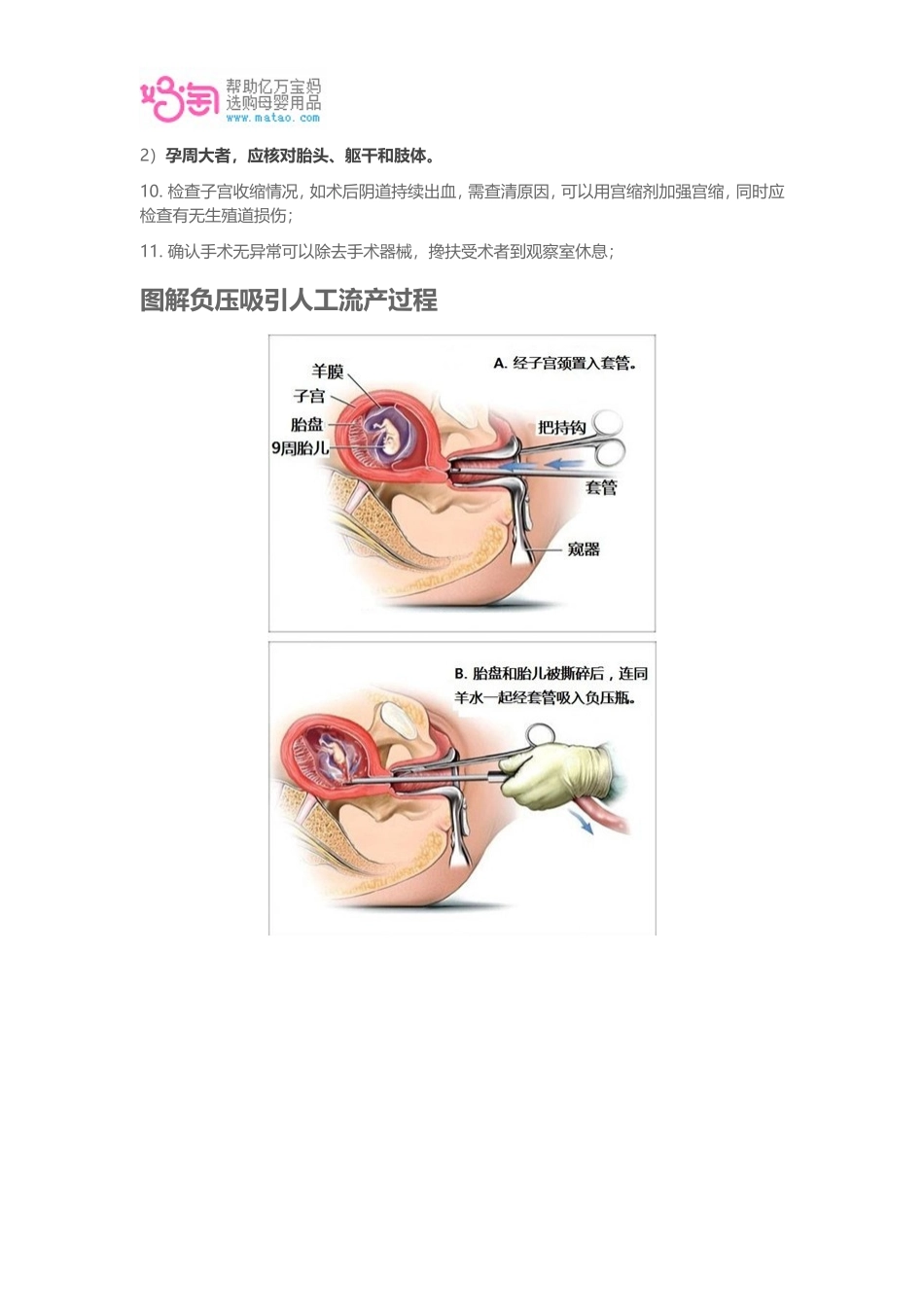 人工流产有哪些后遗症_第3页