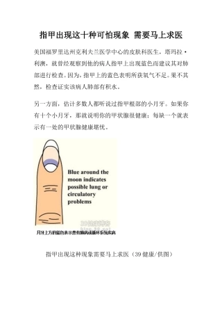 指甲出现这十种可怕现象 需要马上求医
