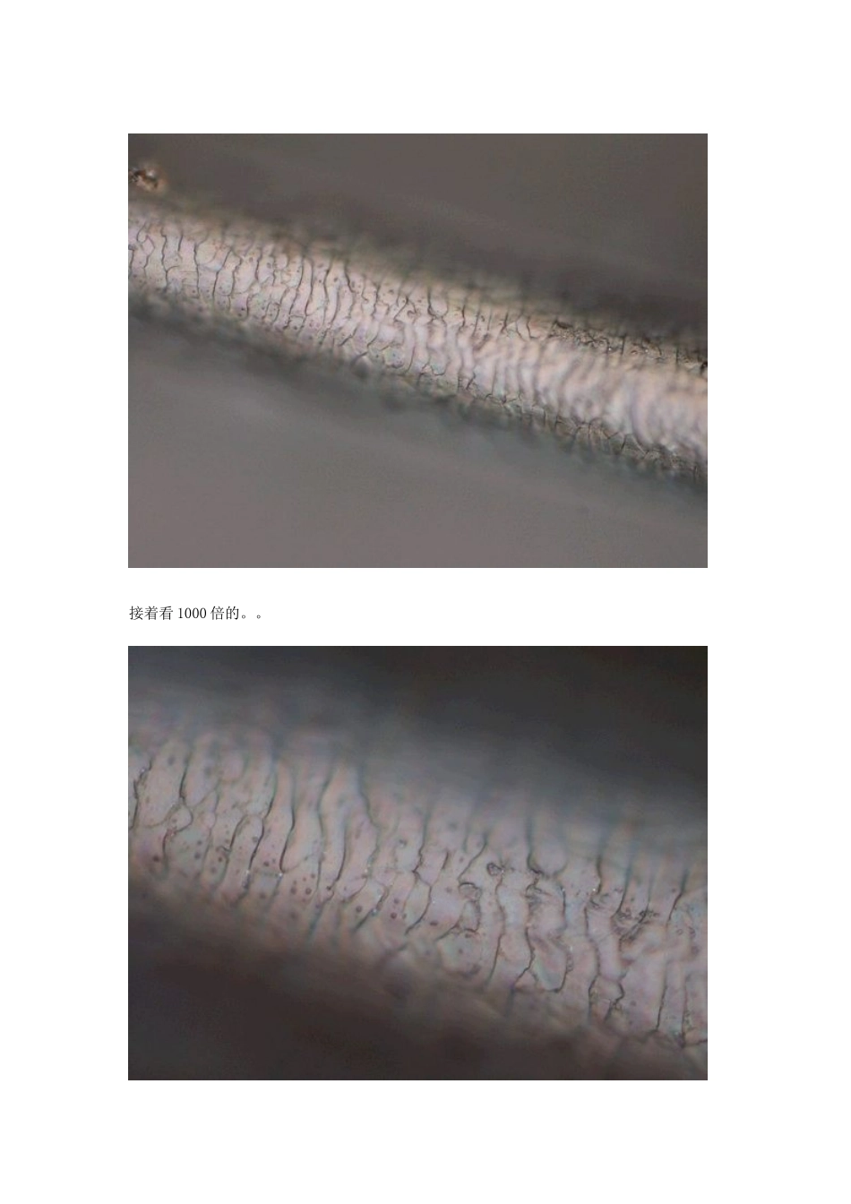 放大1000倍的头发,是怎样的？_第2页