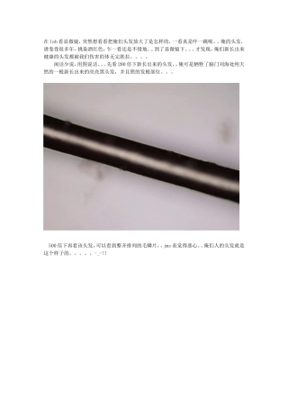 放大1000倍的头发,是怎样的？