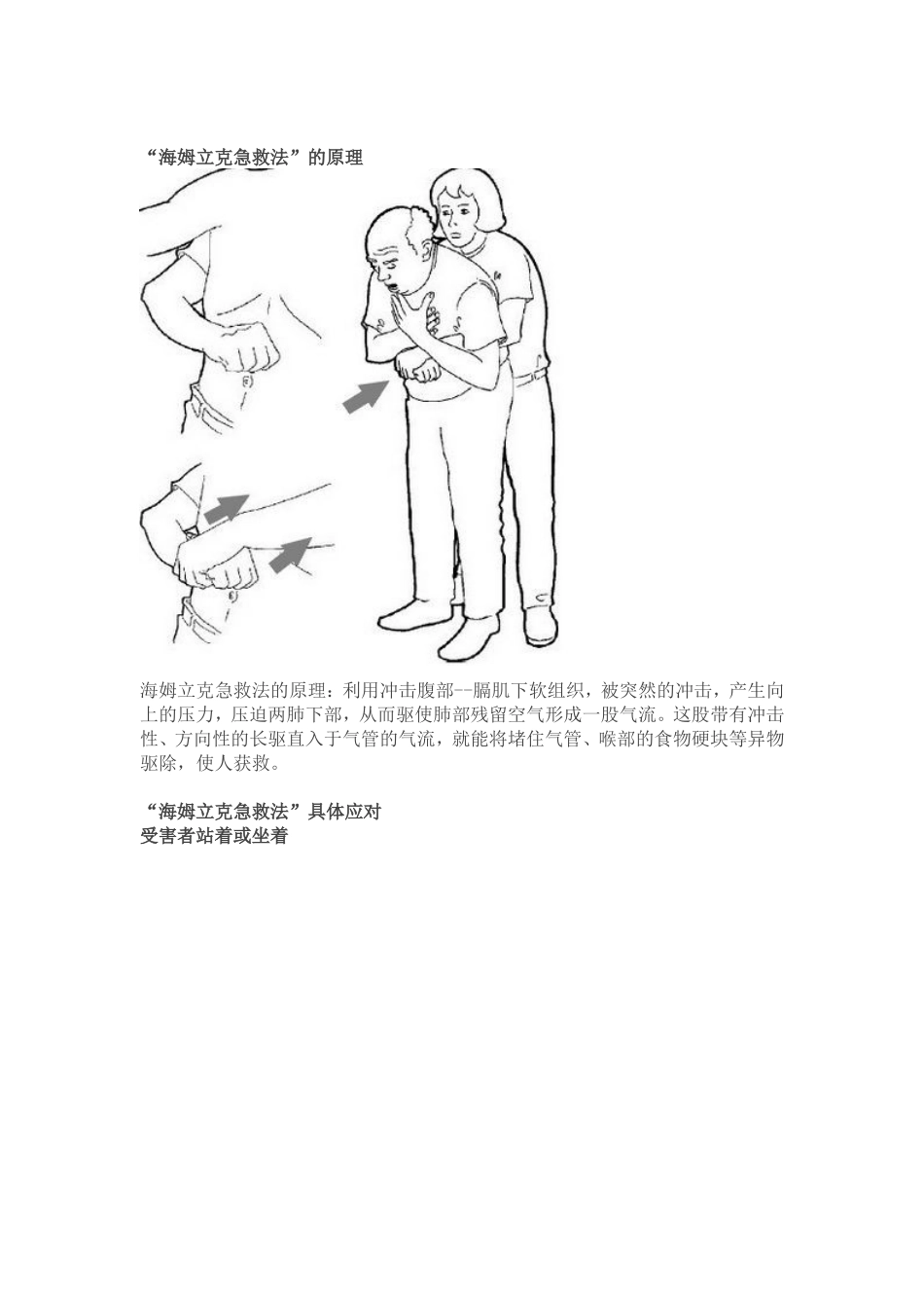 食物卡喉千万别拍背部!救了100多万人的“海姆立克急救法_第2页