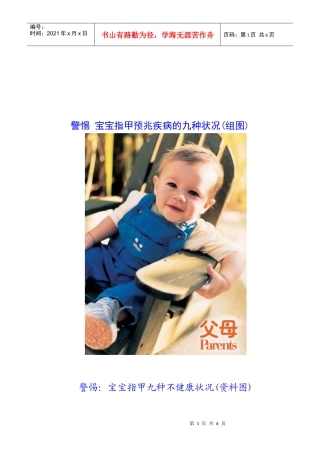 宝宝指甲预兆疾病的九种状况