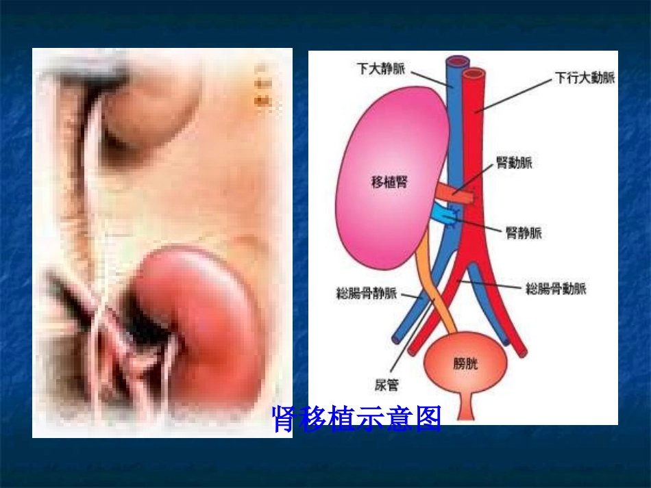 《尿的形成与排出》课件_第3页