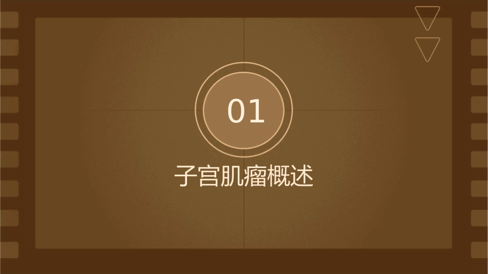 子宫肌瘤术前术后护理课件_第3页