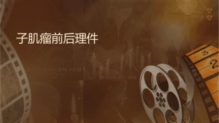 子宫肌瘤术前术后护理课件