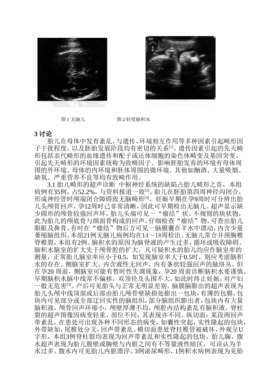 超声对胎儿畸形的诊断与鉴别_第2页
