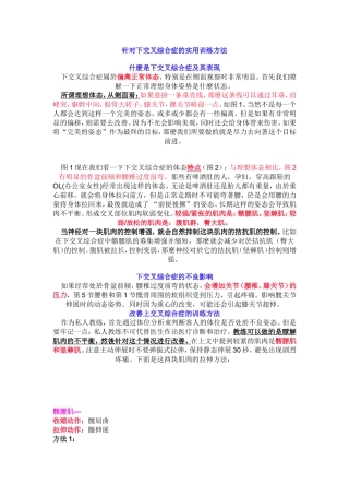 下交叉综合症的实用训练方法