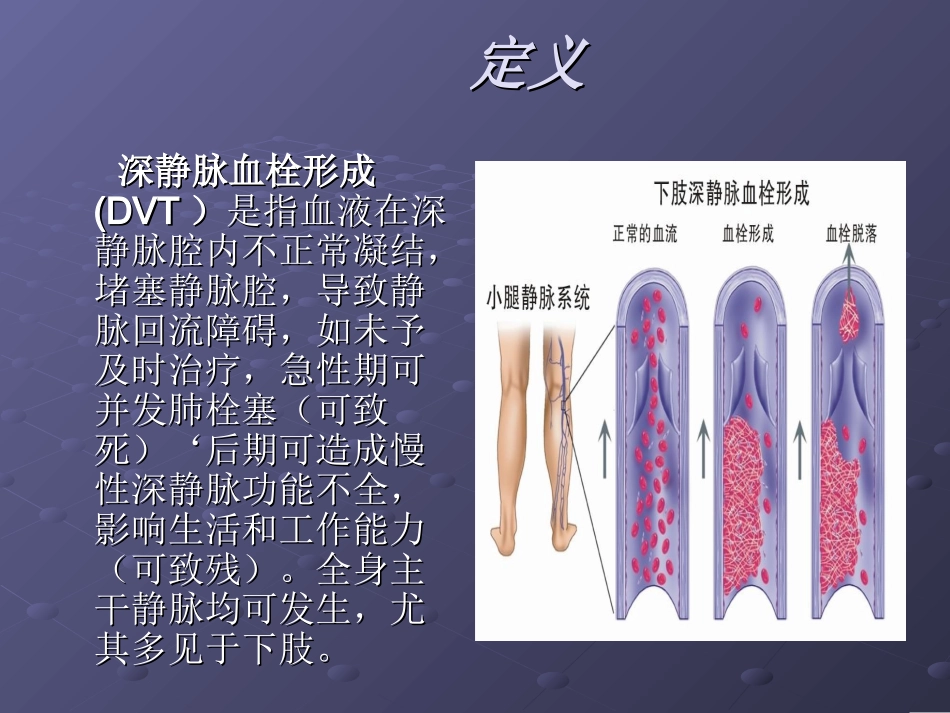 下肢深静脉血栓形_第2页