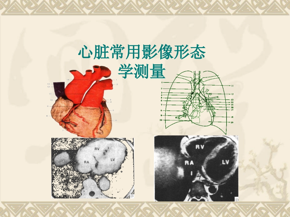 心脏的影像形态学测量_第1页