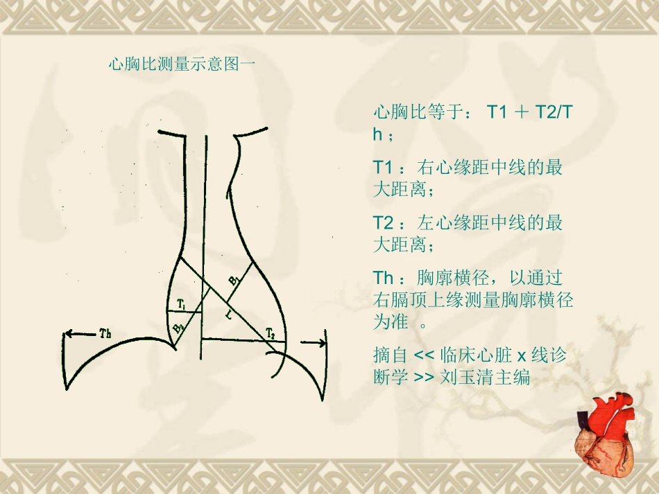 心脏的影像形态学测量_第3页