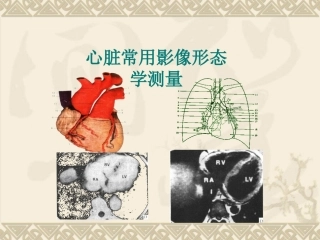 心脏的影像形态学测量