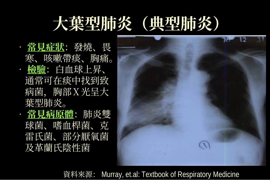 严重急性呼吸道症候群_第2页
