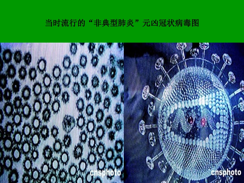 永远的白衣战士李普玲课件_第2页