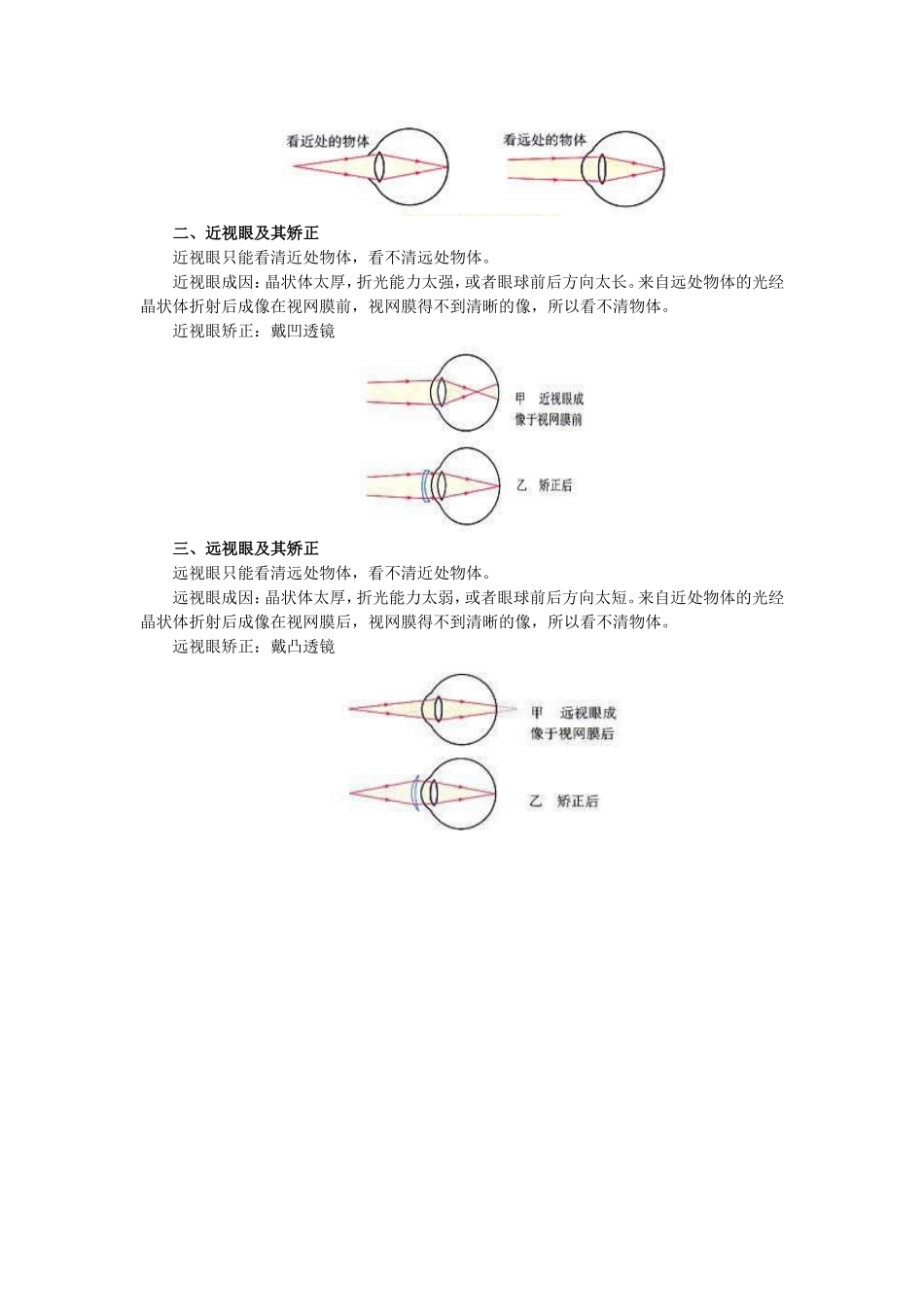 《眼的成像原理-视力的矫正》教案2_第2页
