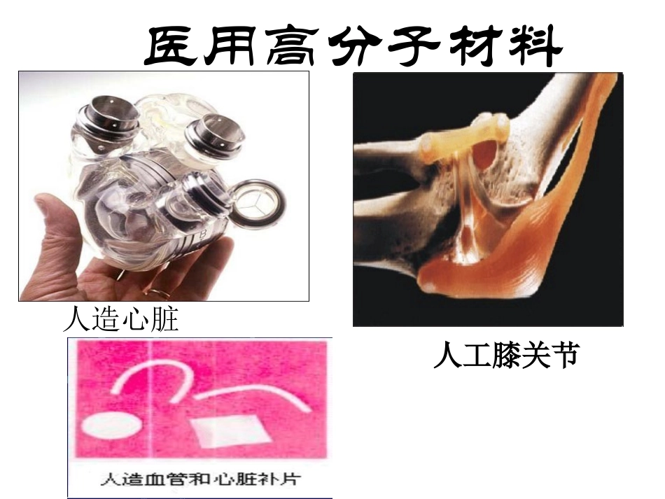 人教版化学选修五：应用广泛的高分子材料_第2页