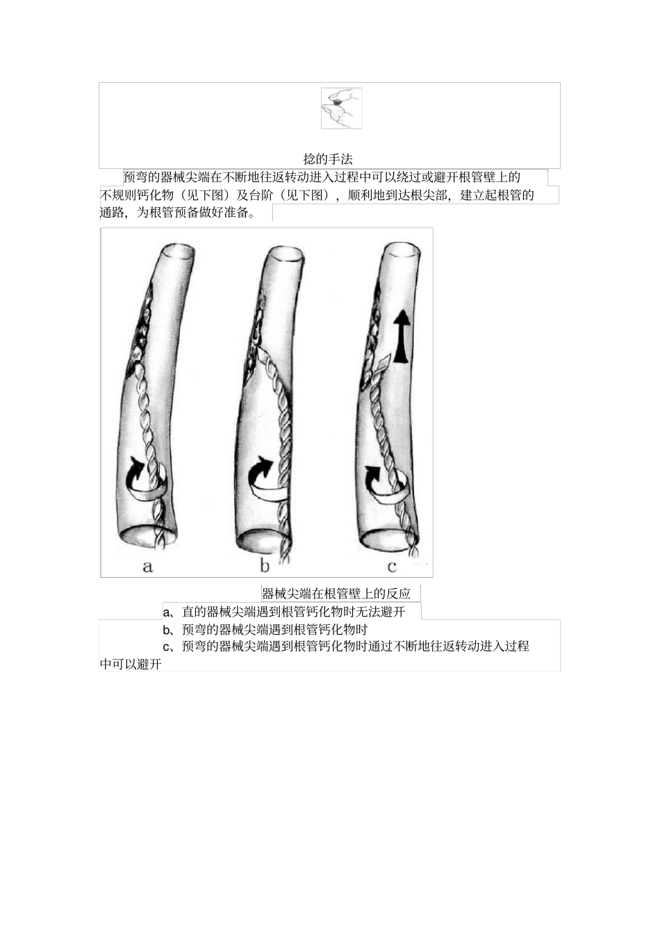 各牙的开髓洞型_第3页