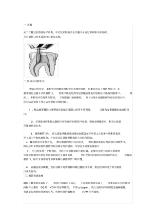 各牙的开髓洞型
