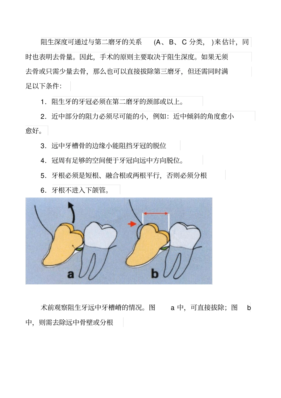 各种阻生牙的处理方法_第3页