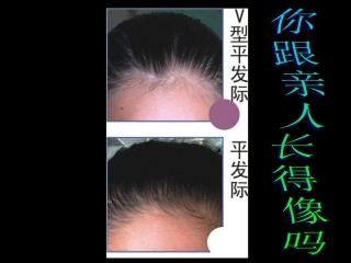 你跟亲人长得像吗？