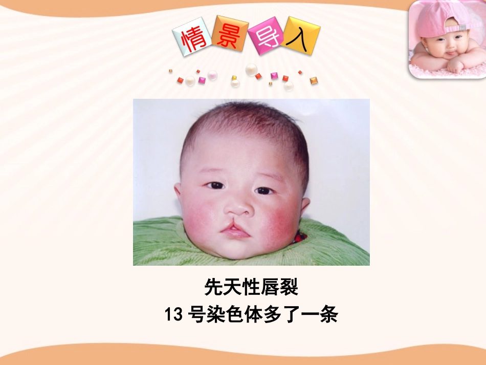 第四节遗传病和优生优育_第2页