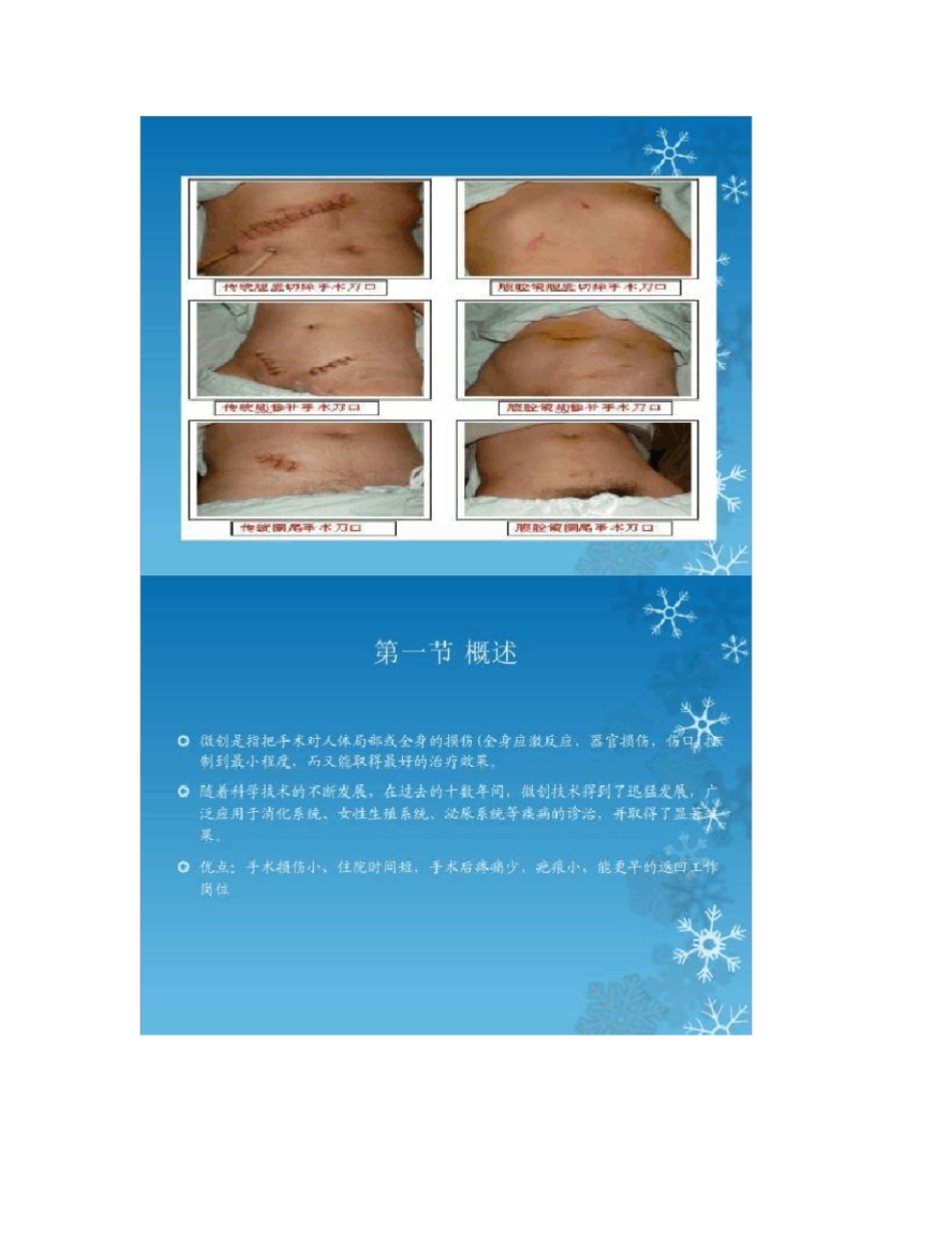 外科微创技术_第2页