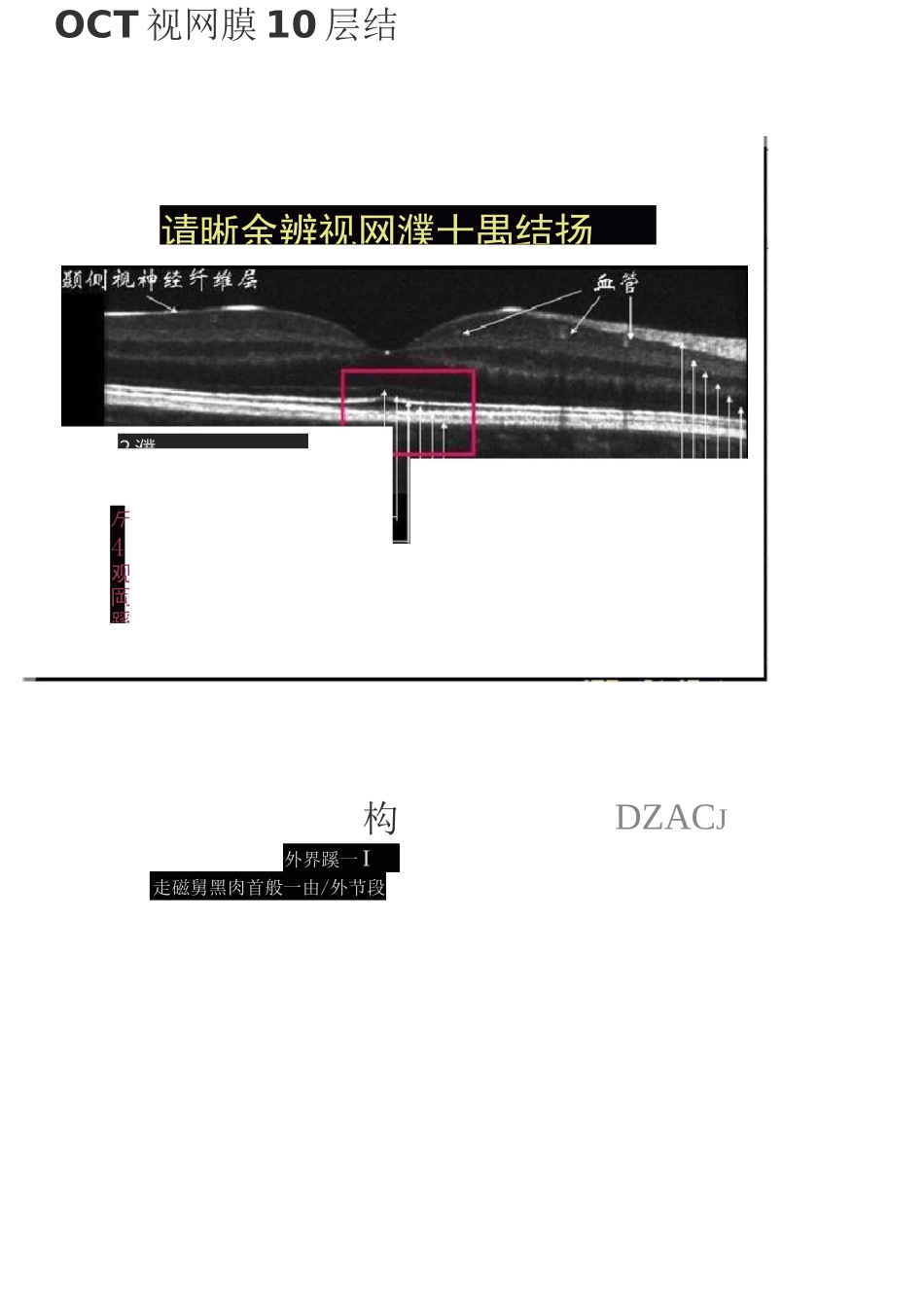 OCT视网膜10层结构讲解_第1页