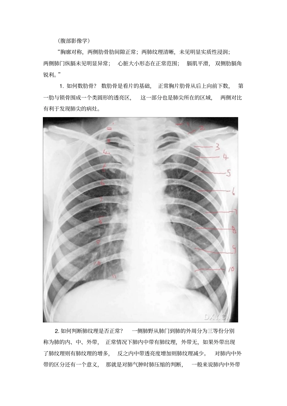 如何看胸片讲解_第1页