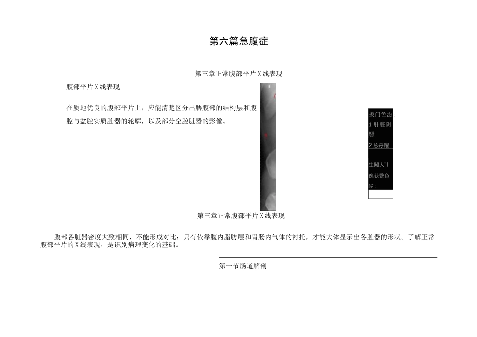 正常腹部平片X线表现_第2页